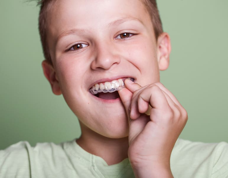 Cool Smiles Orthodontics - Kids Invisalign